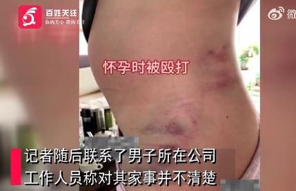 关于家庭暴力，你们怎么看？欢迎大家共同提出案例为广大女性提供帮助女子遭丈夫家暴失明视频怎样摆脱家暴的渣男 蓝牙