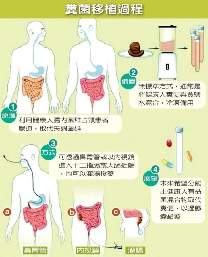 粪菌移植减肥怎么样捐粪便年入8.3万捐粪便怎么申请 乐视